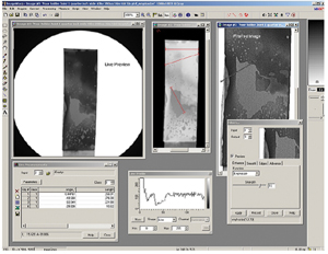 X-Ray Solution